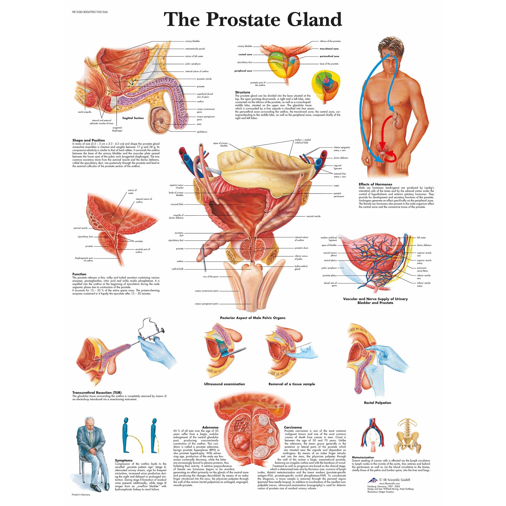 3B Scientific The Prostate Gland Chart