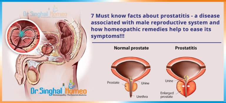 7 Must Know Facts About Prostatitis