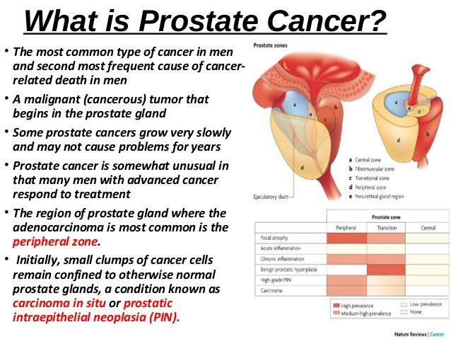 7 things you should know about prostate cancer.