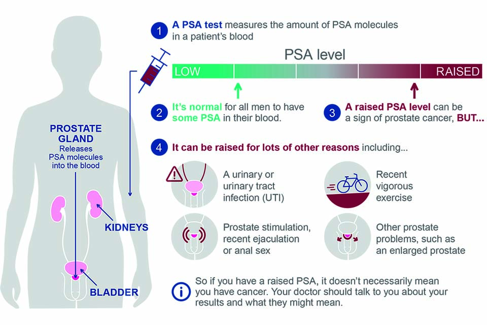 Advising well men about the PSA test for prostate cancer: information ...