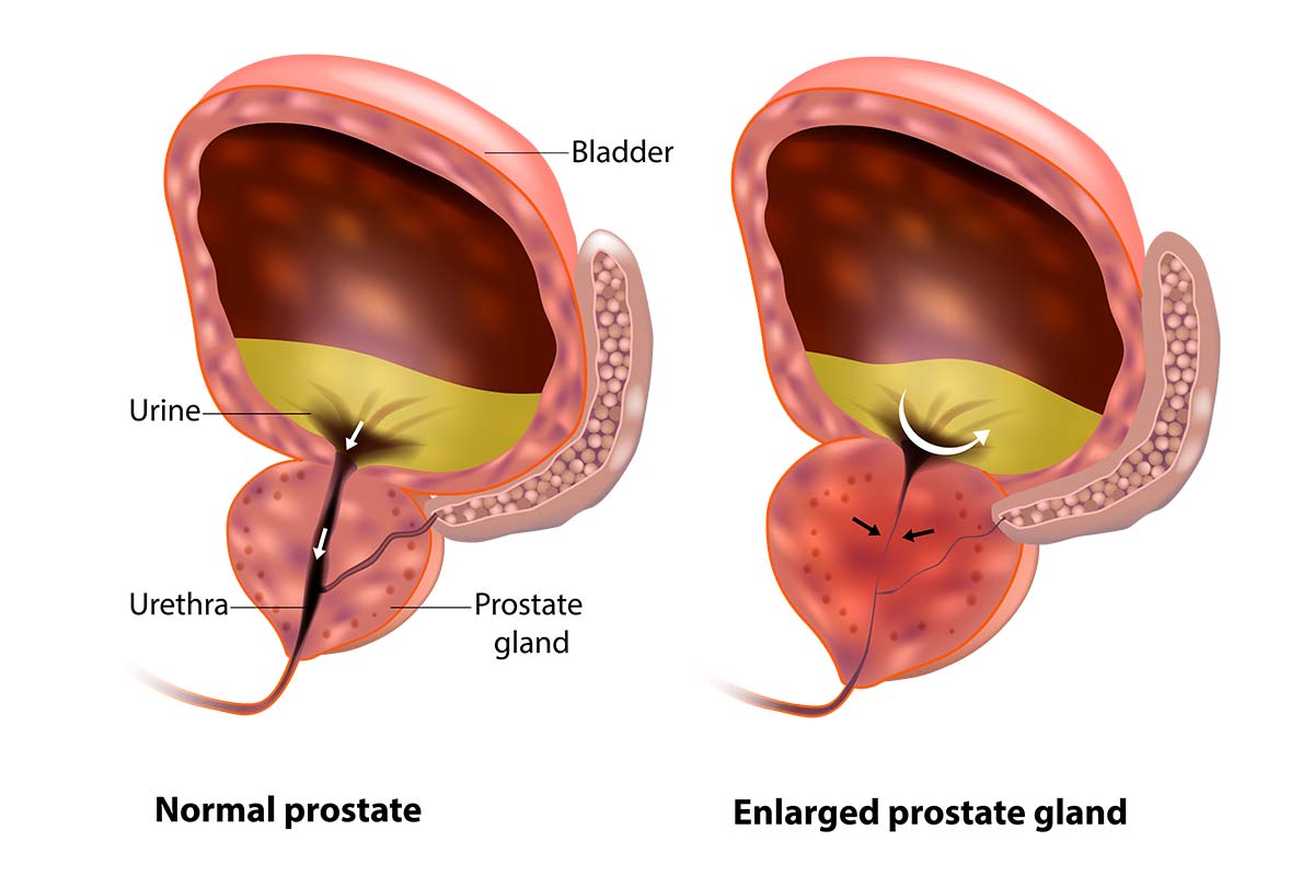 Where does the prostate gland lie
