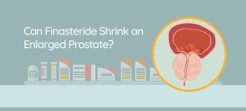 Can Finasteride Shrink an Enlarged Prostate?
