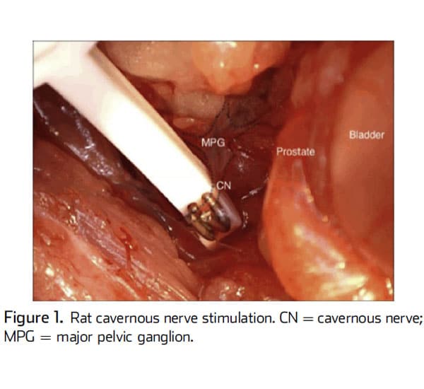 Consensus Statement on the Use of the Cavernous Nerve Injury Rodent ...