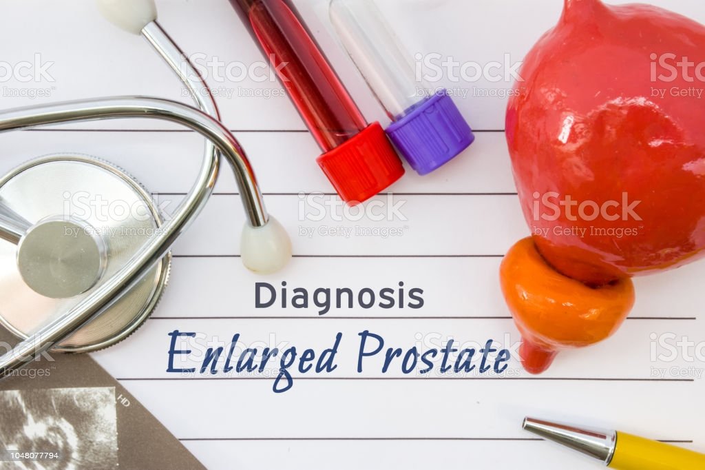 Diagnosis Of Enlarged Prostate Figure Of Prostate Is ...