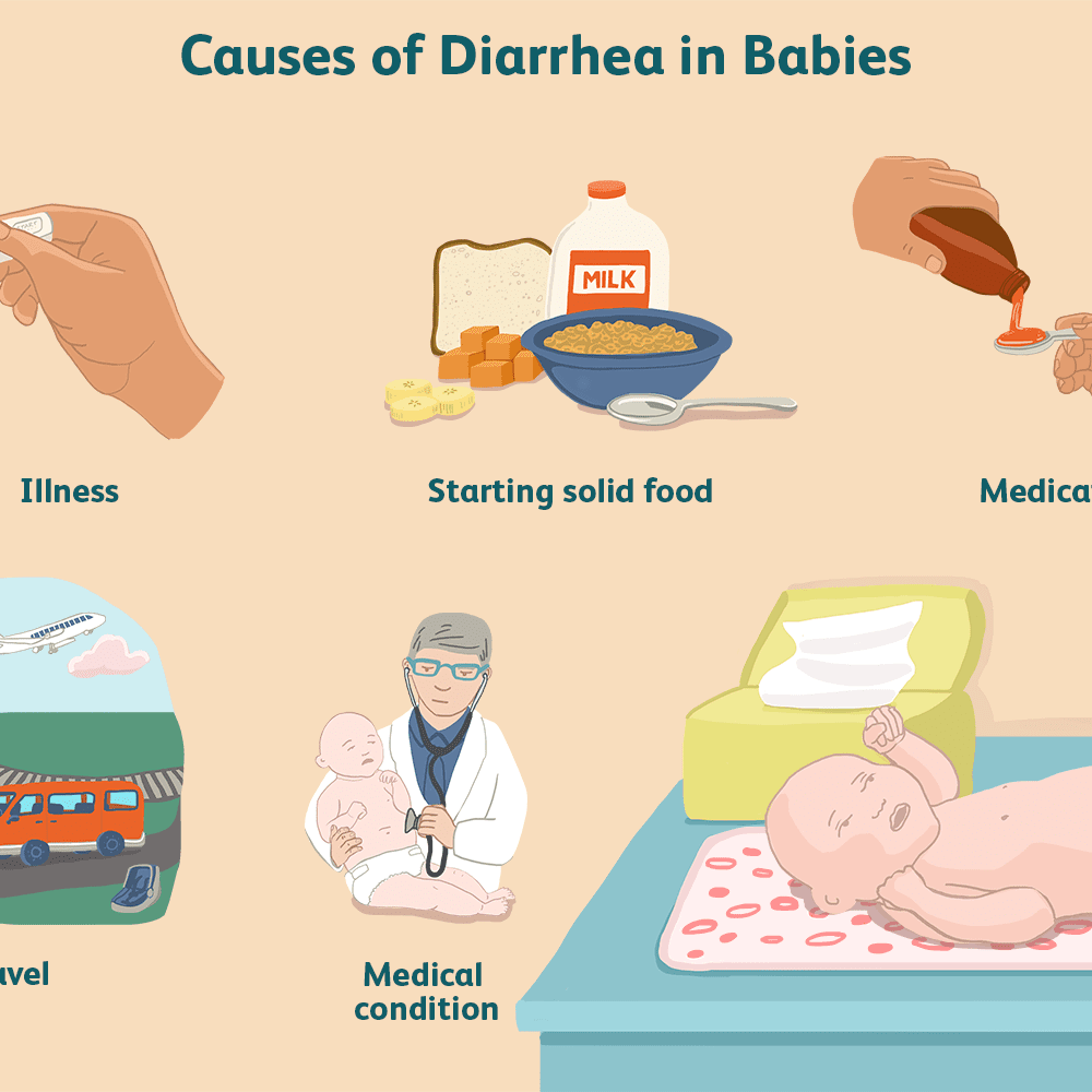 Diarrhea 4 days, Translation of " diaree de"  in English Diarrhea for 4 ...