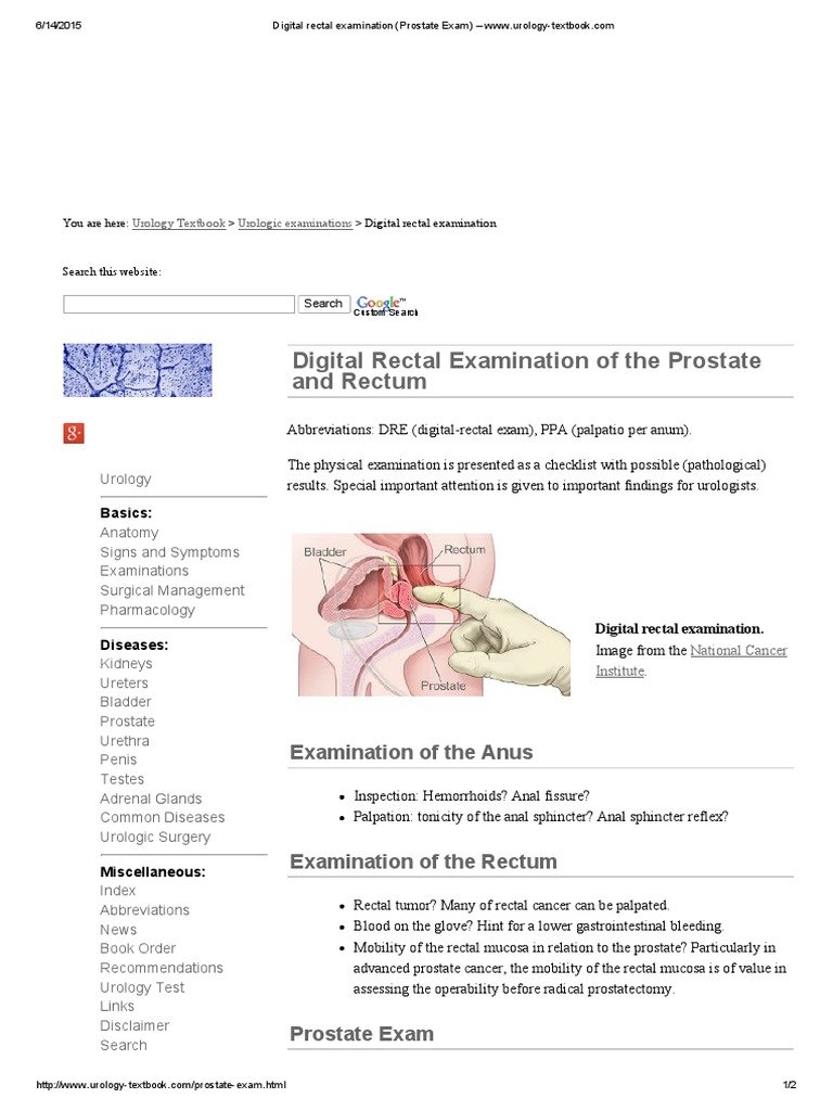 Digital Rectal Examination (Prostate Exam) â Www.urology ...