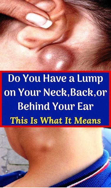 Do You Have a Lump on Your Neck,Back,or Behind Your Ear ...