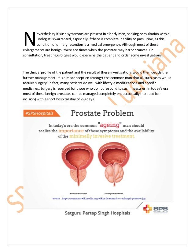 Do you have a prostate problem?