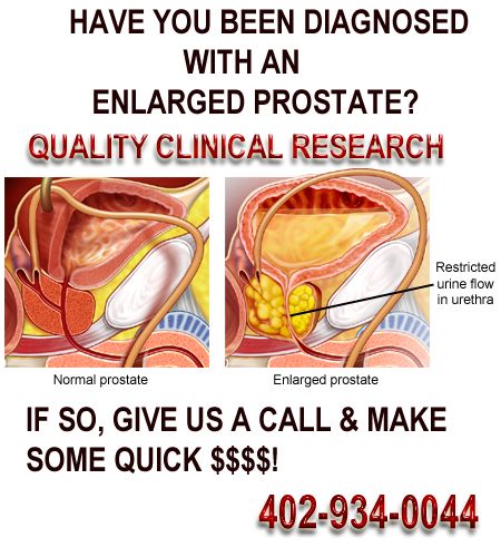 Do you have an enlarged prostate and looking for extra $$$? Well give ...