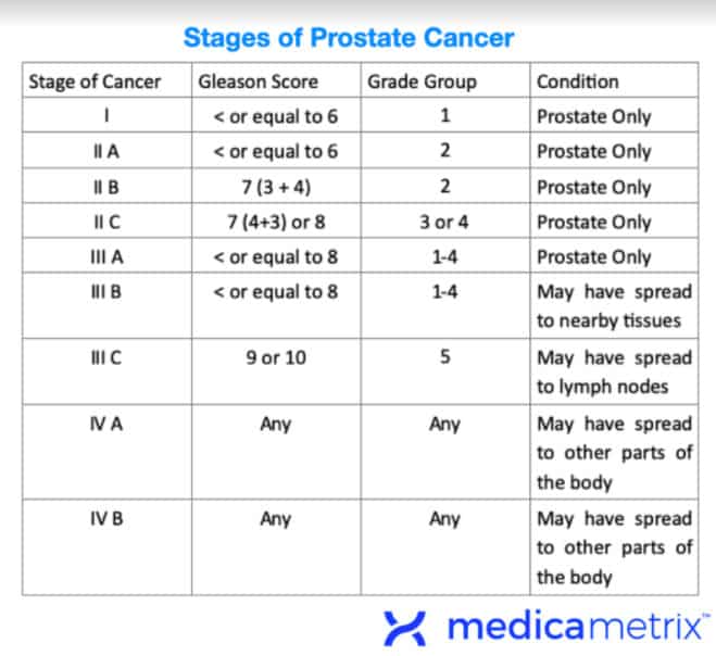 Early Symptoms of Prostate Cancer  MedicaMetrix