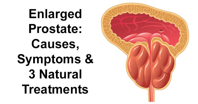 Does prostate cancer cause enlarged prostate