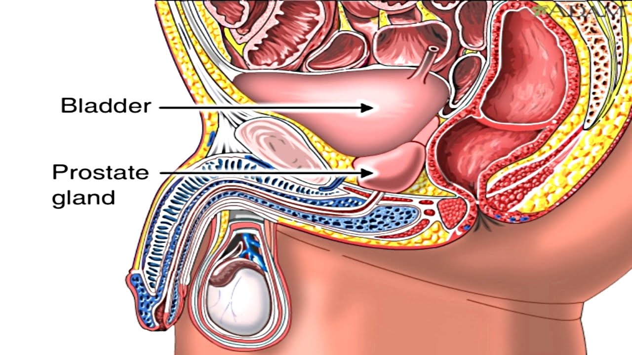 Enlarged Prostate Gland: Benign Prostatic Hyperplasia ...