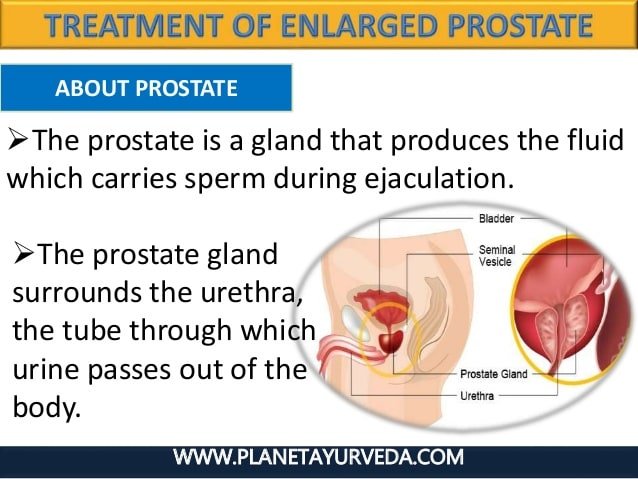 Enlarged prostate self diagnosis online