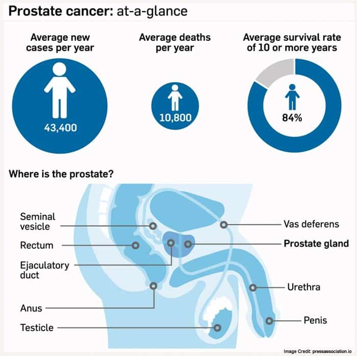 Examining the Relationship Between Prostate Cancer and Obesity