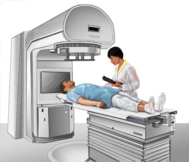 External Beam Radiation Therapy for Cancer  thailandcancerhelp.com