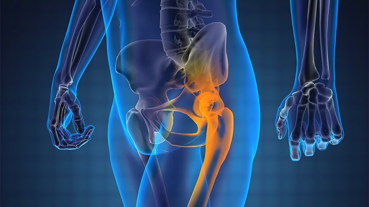 FAQs About Prostate Cancer That Has Spread to the Bones ...