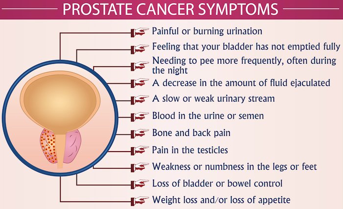 Get to Know Your Prostate