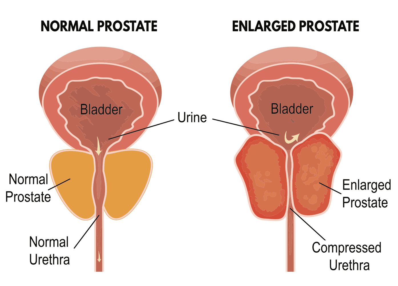 Healing Homeopathy: Prostate Problems?? Common sign of old ...