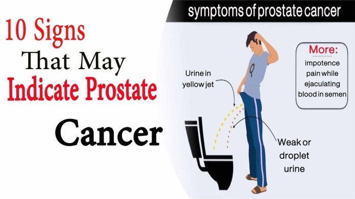 Health Corner: 10 Signs That May Indicate Prostate Cancer