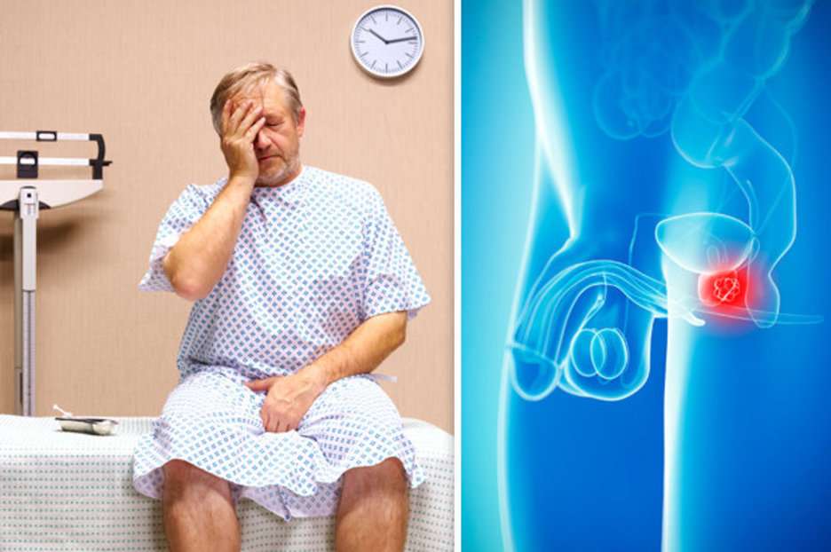 Hip And Leg Ache With Prostate Cancer â The Hip Flexor