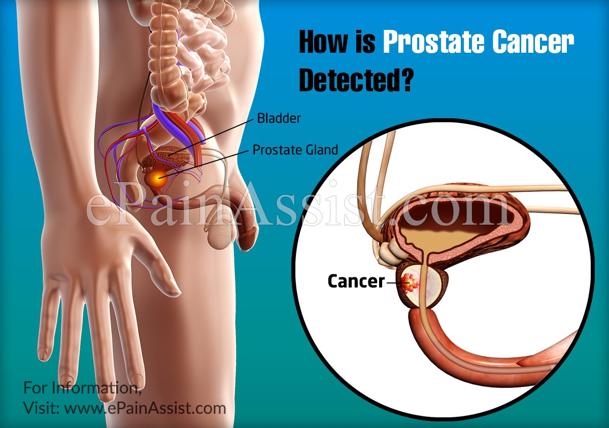 Where is the prostate located in a man