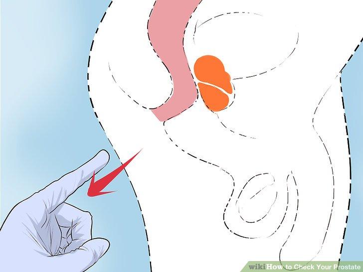 How to Check Your Prostate