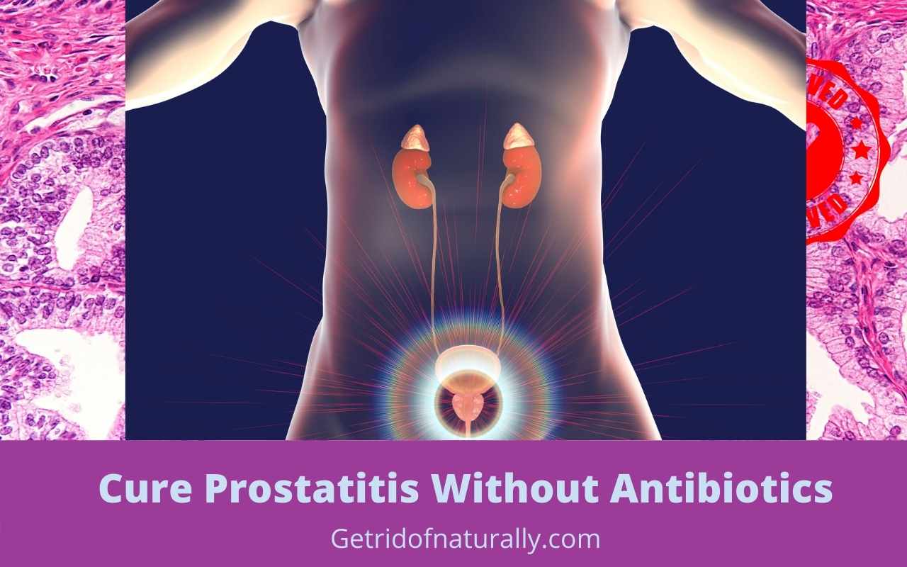 How to Get Rid of Prostatitis : Cure Prostatitis without ...