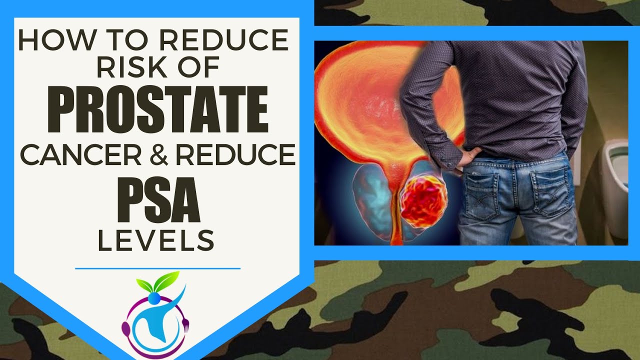 How To Reduce Risk For Prostate Cancer &  Lower PSA Levels ...