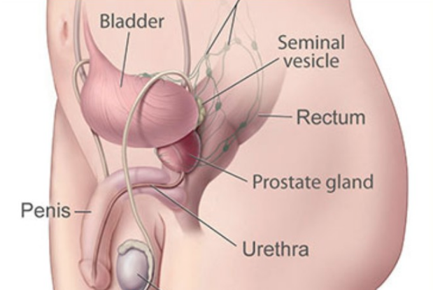 How To Reduce Your Risk Of Prostatitis â Health Hub