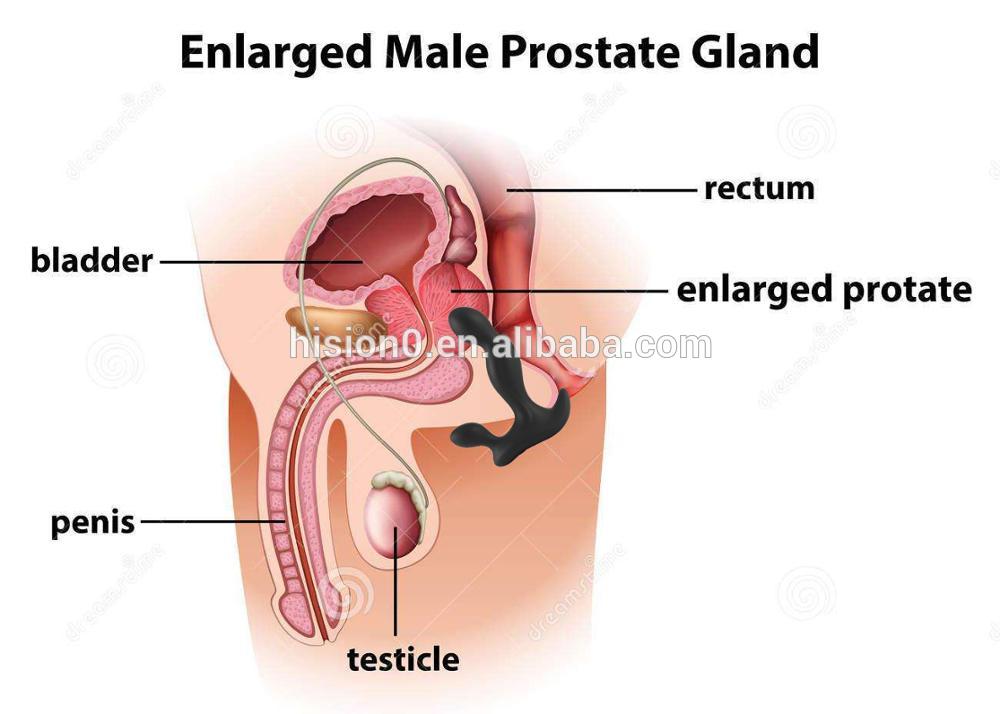 How to stimulate a mans prostate. How to massage a man