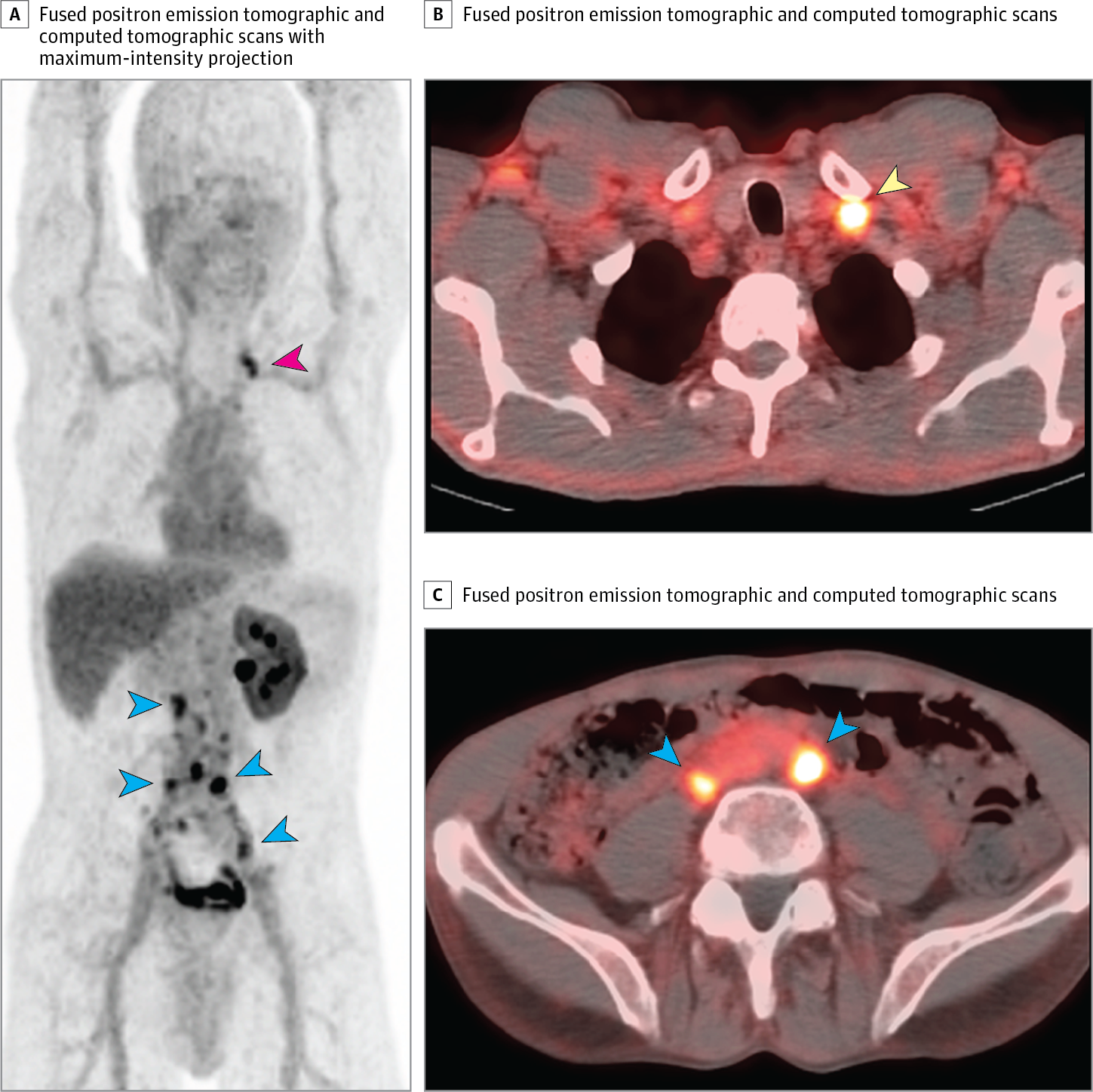 Imaging Locally Advanced, Recurrent, and Metastatic Prostate Cancer: A ...