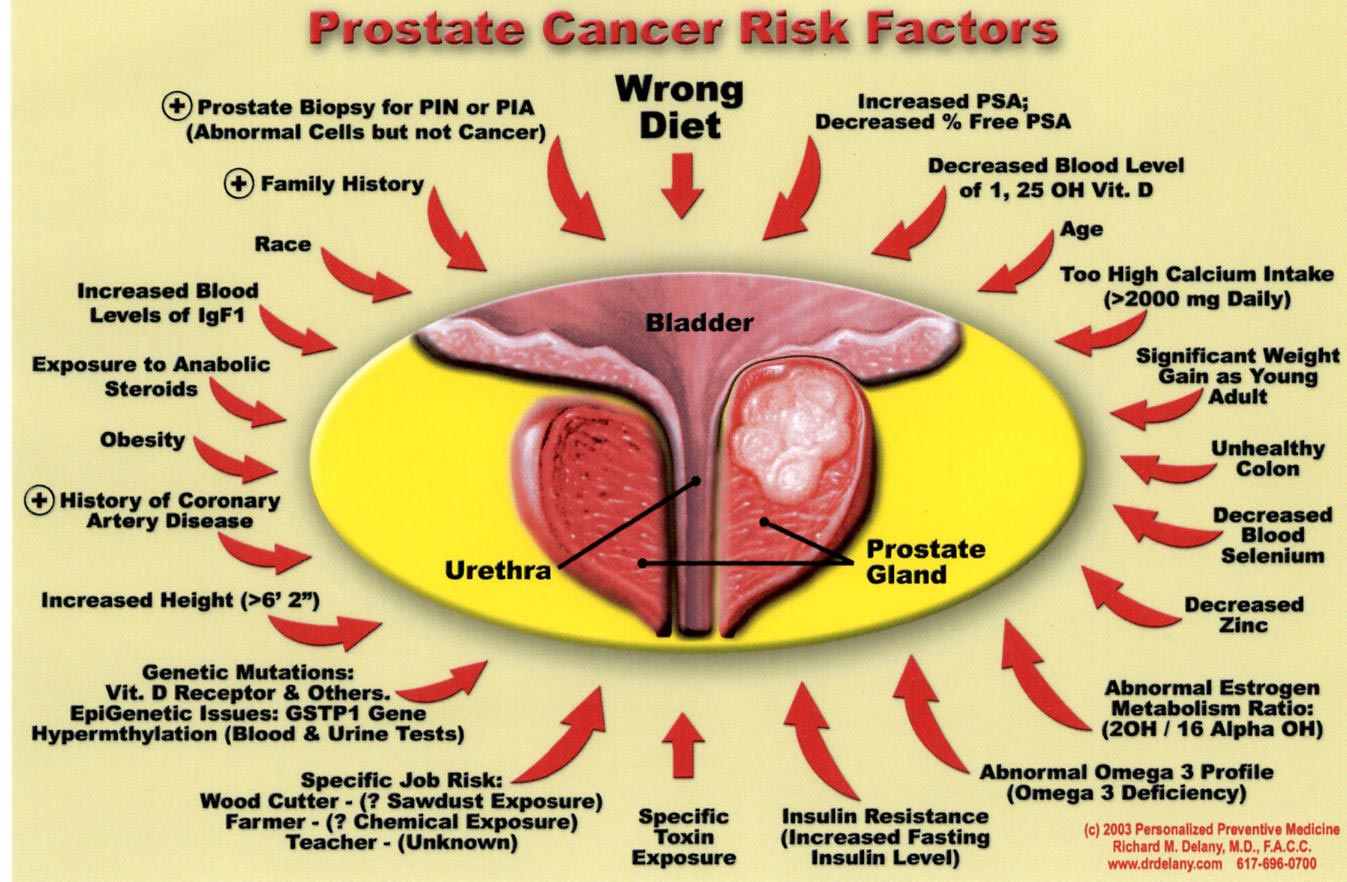 Keeping it Simple (KISBYTO): Prostate Cancer Month