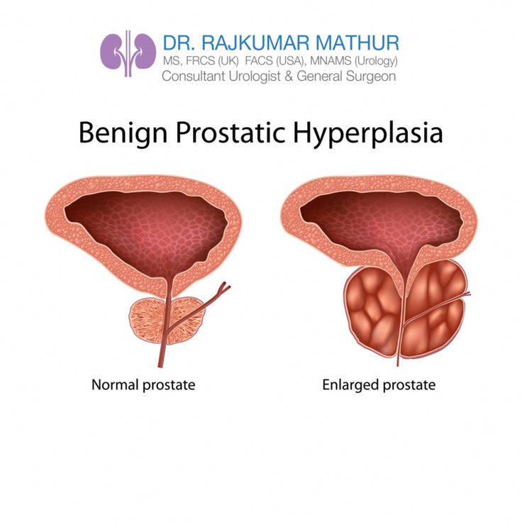 Lots of men will certainly encounter a prostate issue at some time in ...