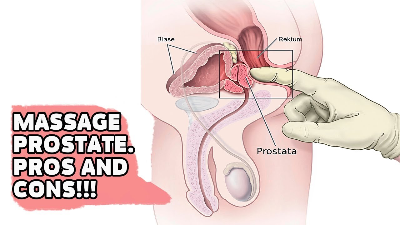 MASSAGE PROSTATE YES OR NO