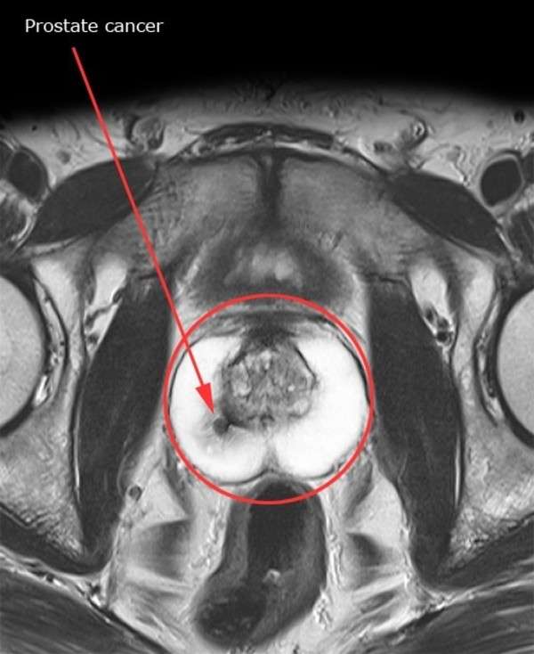 MRI: My Radiology Insight