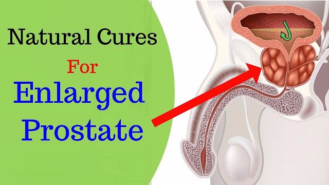 Natural Solution To prostate Problems