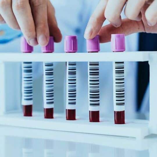 New Blood Test Can Detect Prostate Cancer