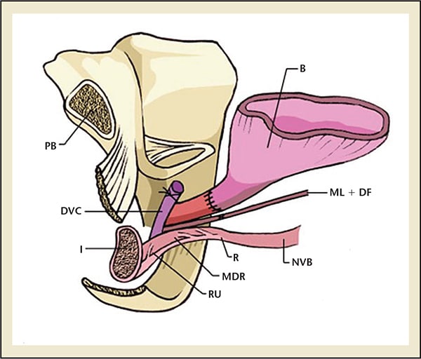 Post Prostate Surgery Urinary Incontinence