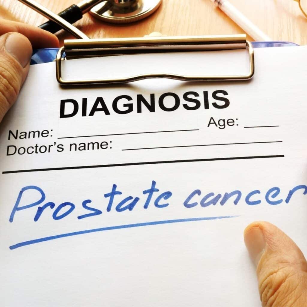 Prostate cancer: 11 common questions answered