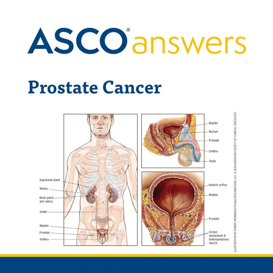 Prostate Cancer Fact Sheet (pack of 50 fact sheets): ASCO Store
