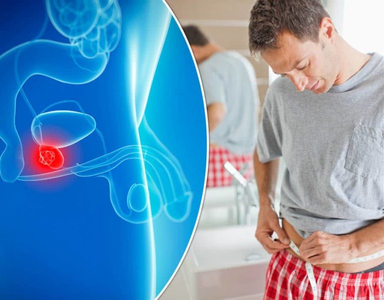 Prostate Cancer: Meaning, Location, Symptoms and Treatments