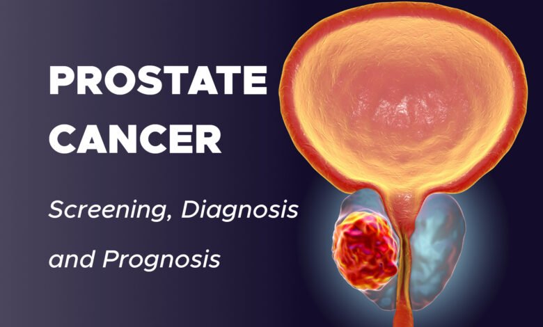 Prostate Cancer: Screening, Diagnosis and Prognosis ...