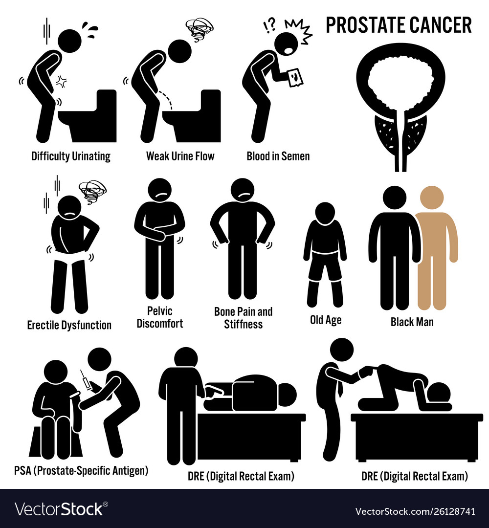 Prostate cancer symptoms causes risk factors Vector Image