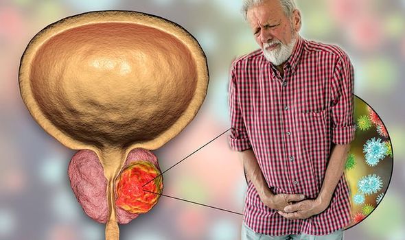 Prostate cancer symptoms: Signs include difficulty passing ...