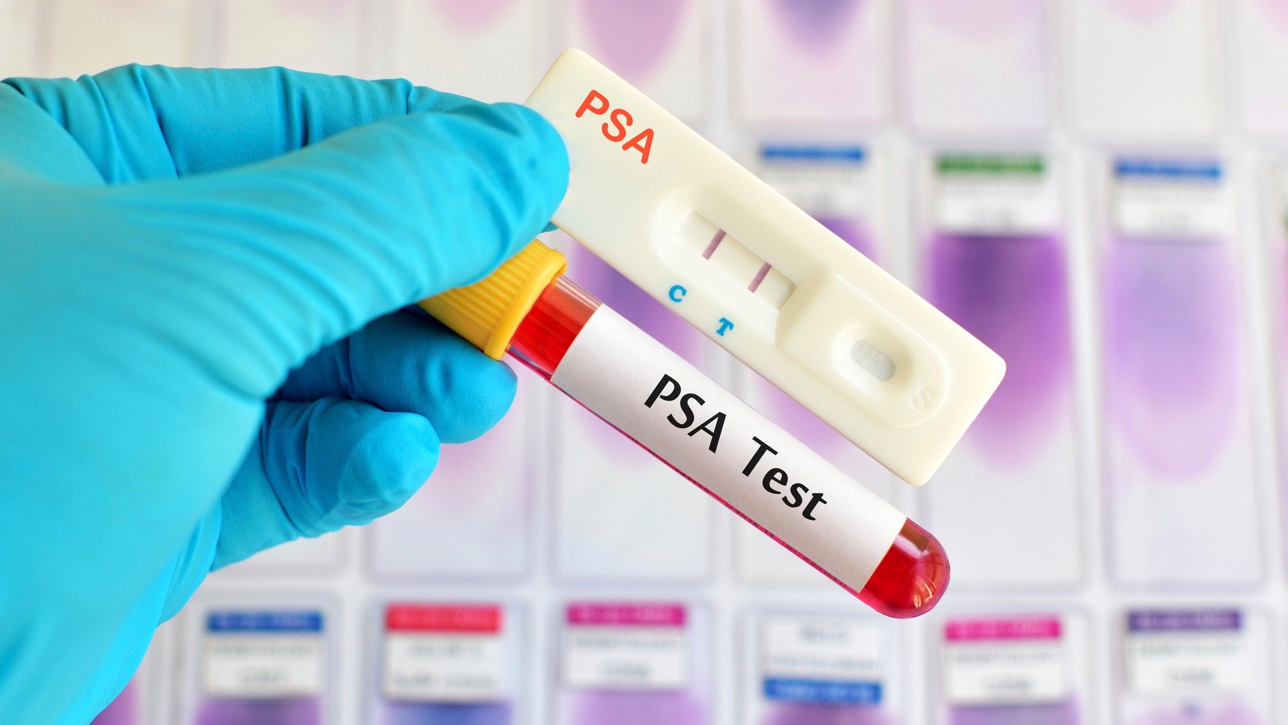 Prostate cancer tests are now OK with panel, with caveats ...