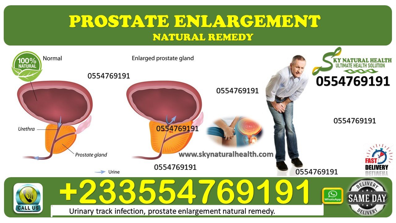 Prostate Enlargement Treatment Pack  Sky Natural Health