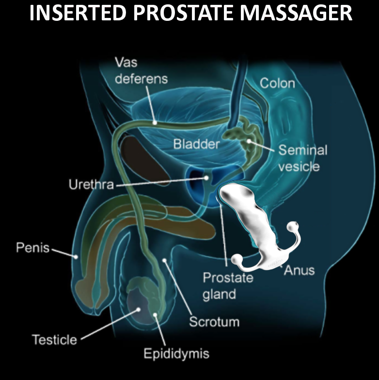 Prostate Info