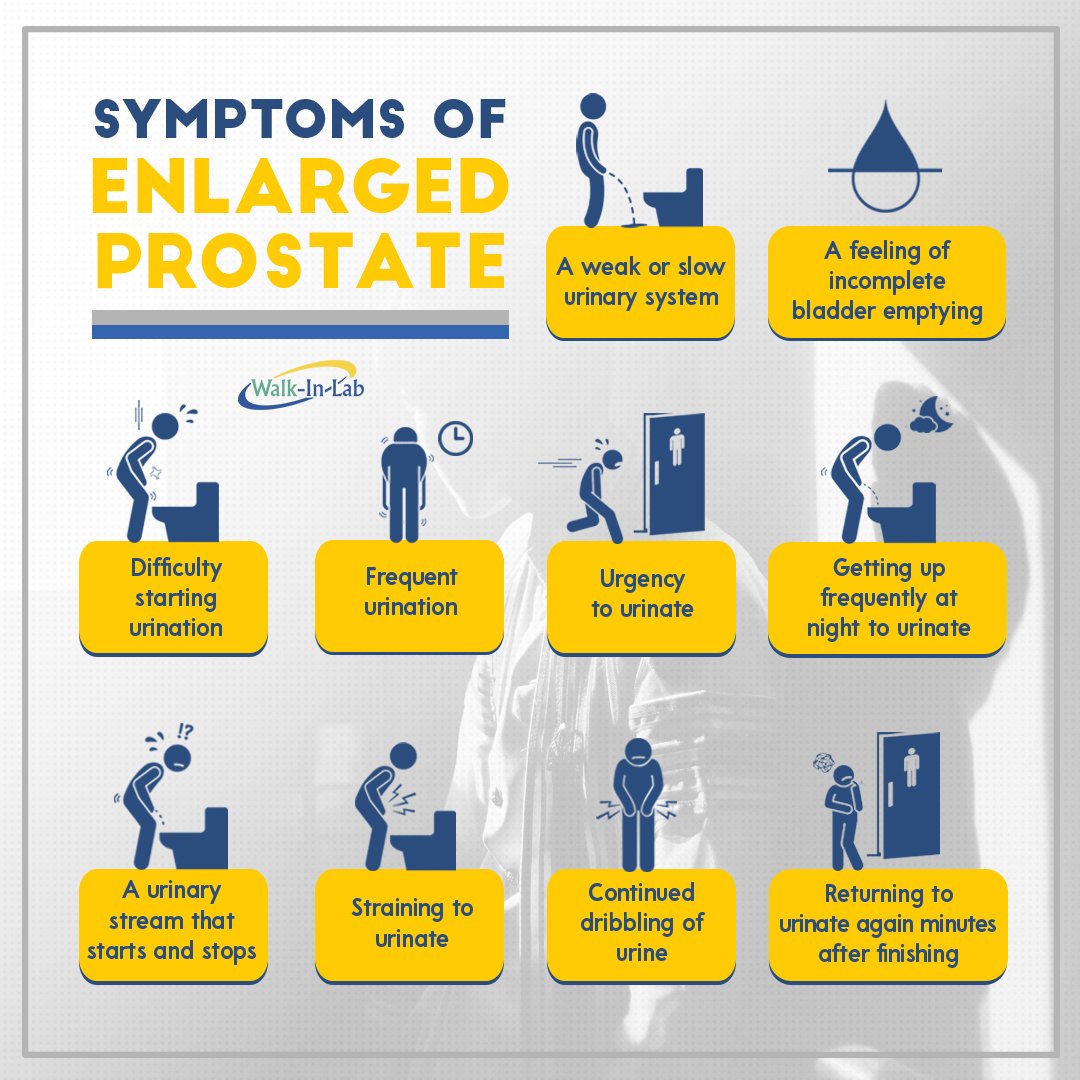 Prostate Problems? These Are The Main Symptoms