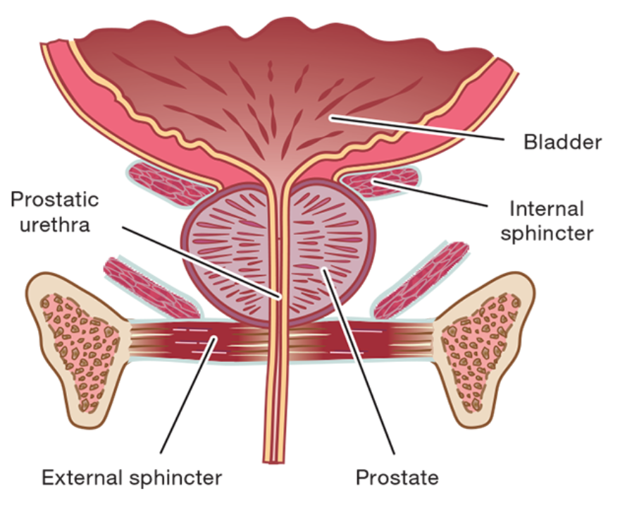 Prostate Removal And Incontinence