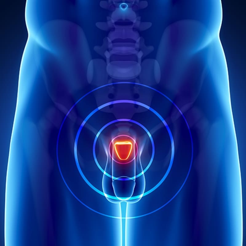 Prostate &  Urologic Cancers